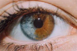 Les différents yeux et leur rareté – Aujourd'hui 100 Faute