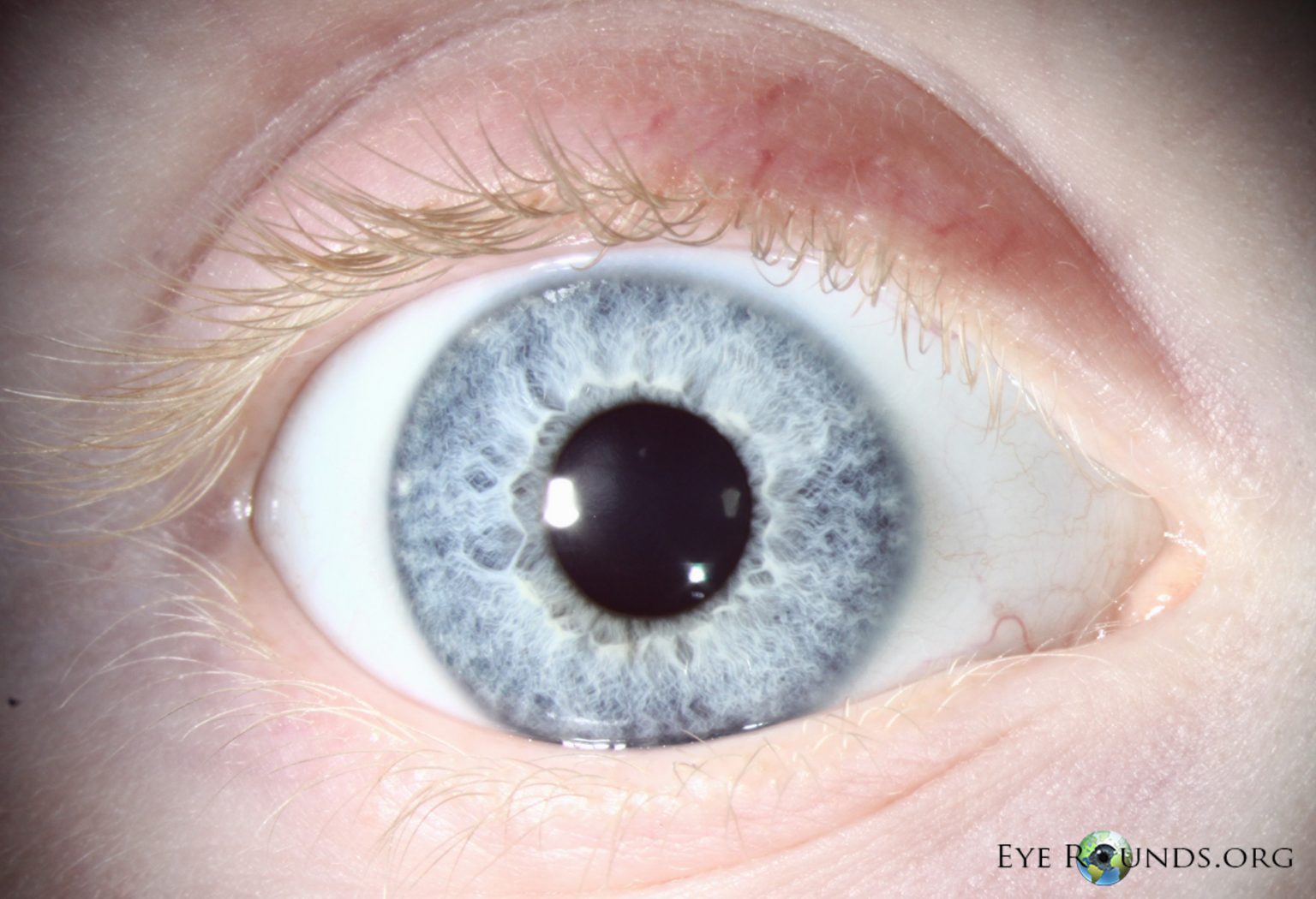 Les différents yeux et leur rareté – Aujourd'hui 100 Faute